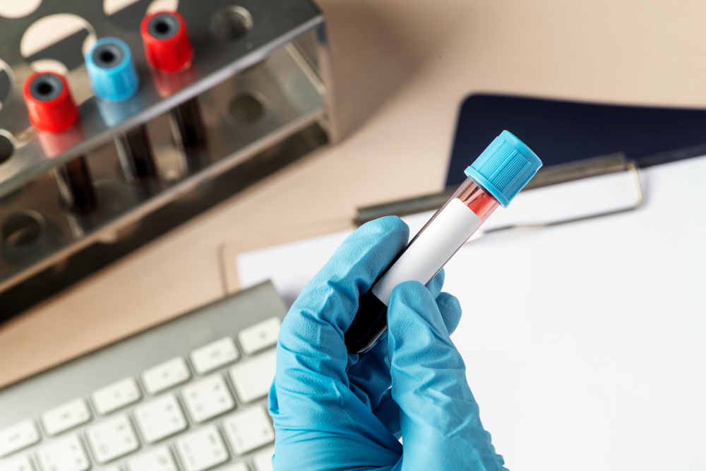 hematología clínica
